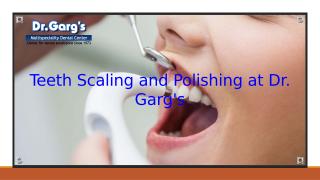 Teeth Scaling and Polishing at Dr Garg_s.pptx